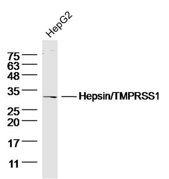 Hepsin/TMPRSS1 Rabbit Polyclon