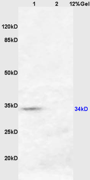 HSD17B3 Rabbit Polyclonal Anti