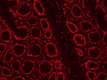CLK2 Rabbit Polyclonal Antibod