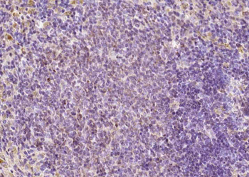 FAM46C Rabbit Polyclonal Antib