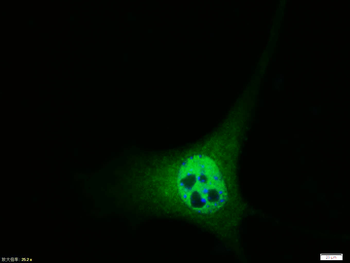 Phospho-Cyclin D1 (Thr286) Rab