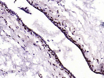 Phospho-YAP1 (Tyr407) Rabbit P