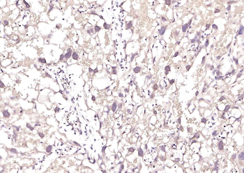 MLC1 Rabbit Polyclonal Antibod