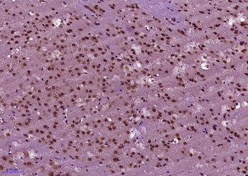 BNC1 Rabbit Polyclonal Antibod