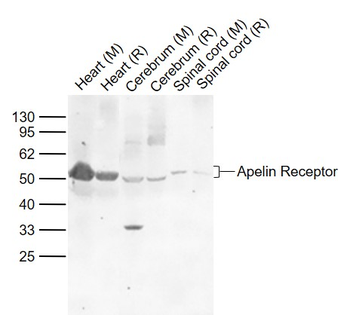 Apelin Receptor Rabbit Polyclo