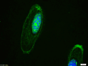 Phospho-beta catenin (Tyr142)