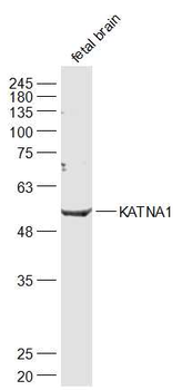 KATNA1 Rabbit Polyclonal Antib