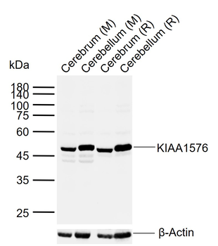 VAT1L Rabbit Polyclonal Antibo