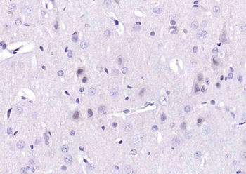 BRCA2 Rabbit Polyclonal Antibo