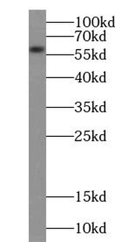 ACSM3 Antibody抗体,orb624467,bio