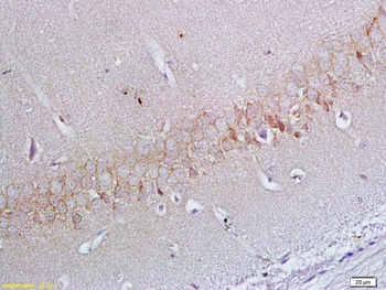 ApoER2 Rabbit Polyclonal Antib