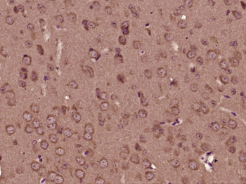 CHRNA9 Rabbit Polyclonal Antib