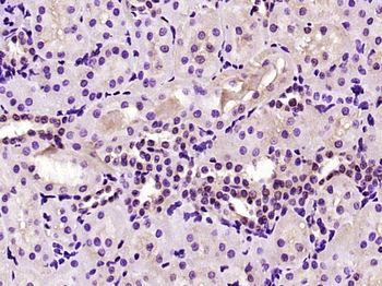 TSEN15/C1orf19 Rabbit Polyclon