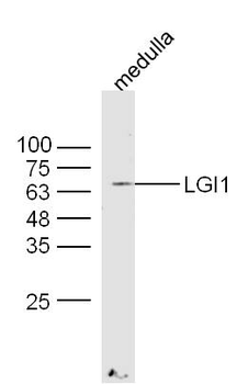 LGI1 Rabbit Polyclonal Antibod