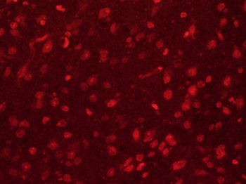 SIP1 Rabbit Polyclonal Antibod