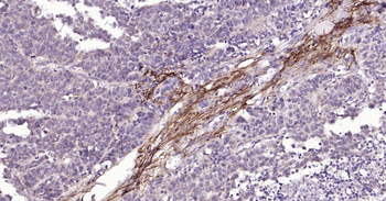 MMP12 Rabbit Polyclonal Antibo