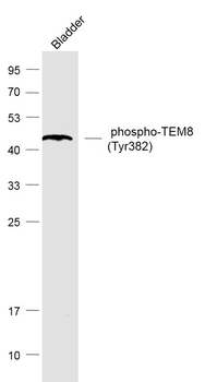 Phospho-TEM8 (Tyr382) Rabbit P
