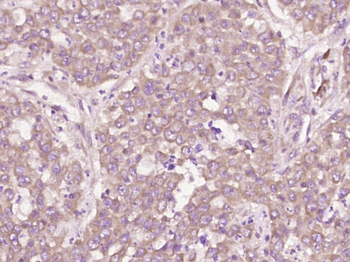 CD97 Rabbit Polyclonal Antibod