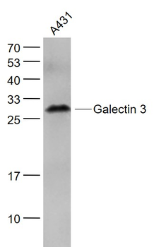 Galectin 3 Mouse Monoclonal An