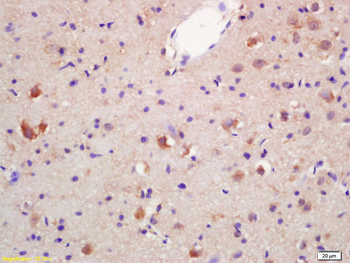 HSD17B3 Rabbit Polyclonal Anti