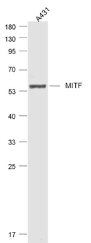 MITF Rabbit Polyclonal Antibod