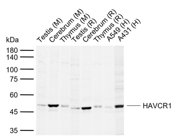 HAVCR1 Rabbit Polyclonal Antib