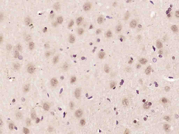 CCDC106 Rabbit Polyclonal Anti