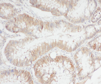 APEH Antibody抗体,orb624385,bior