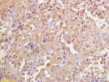 Phospho-BRCA1 (Ser1189) Rabbit