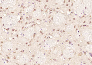 PSF2 Rabbit Polyclonal Antibod