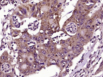 IL-1R1 Rabbit Polyclonal Antib