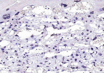 BRCA2 Rabbit Polyclonal Antibo