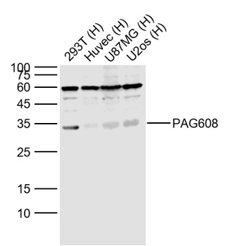 PAG608 Rabbit Polyclonal Antib