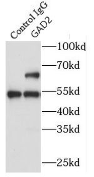 GAD2 Antibody抗体，orb627191，bior