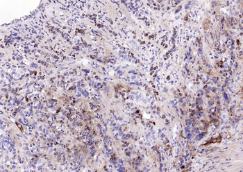 BST2 Recombinant Rabbit Monocl