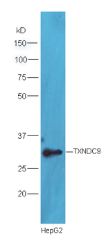 TXNDC9 Rabbit Polyclonal Antib