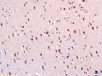 SPTBN2 Rabbit Polyclonal Antib