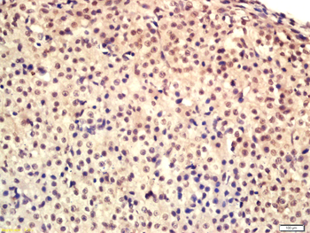 HRG beta 1 Rabbit Polyclonal A