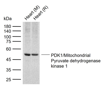 PDK1/Mitochondrial Pyruvate de