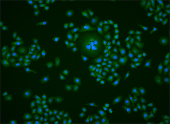 ABCF1 Rabbit Polyclonal Antibo