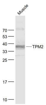 TPM2 Rabbit Polyclonal Antibod