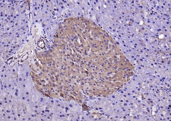 LSM3 Rabbit Polyclonal Antibod