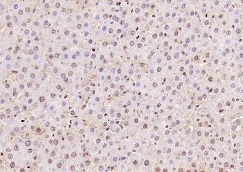 PPM1D Rabbit Polyclonal Antibo
