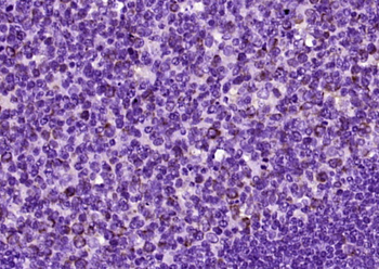 CD40/TNFRSF5 Rabbit Polyclonal