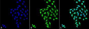 Pp5 R6 PP5 Antibody (PerCP)抗体,orb377035,biorbyt价格_品牌:biorbyt-丁香通