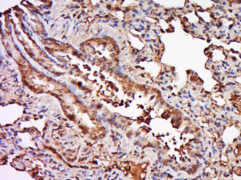 TRAF6 Rabbit Polyclonal Antibo