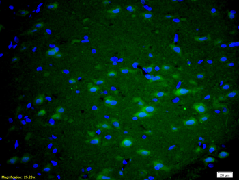 MGluR5 Rabbit Polyclonal Antib