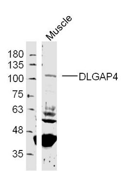 DLGAP4 Rabbit Polyclonal Antib