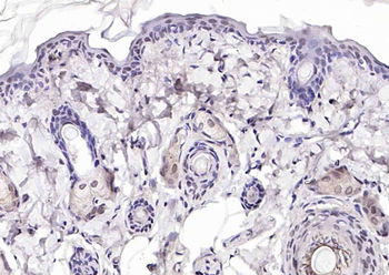 Phospho-P53 (Ser392) Rabbit Po