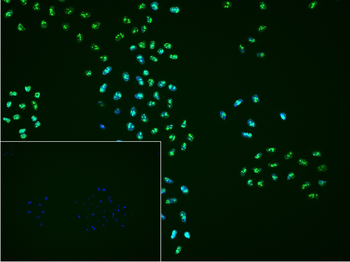 Ki-67 Rabbit Polyclonal Antibo